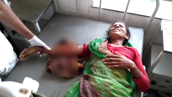 fire on 40 year old woman in Battipura Village of Dholpur fire on 40 year old woman in Battipura Village of Dholpur