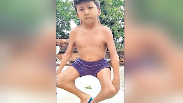 2 लाख में से किसी एक को होती है ऐसी बीमारी
