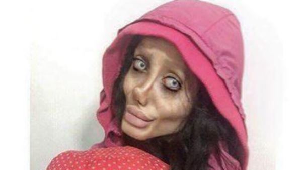कॉस्मेटिक सर्जरी काफी मशहूर है