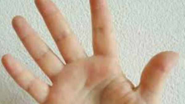 तीन रेखाएं मुख्य रूप से दिखाई देती हैं।