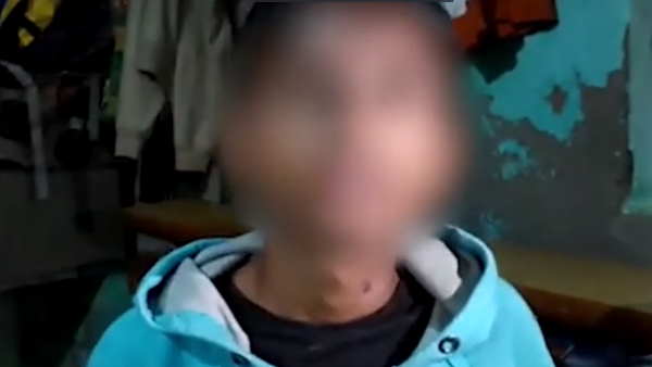 haryana gurugram student throw acid on his friend haryana gurugram student throw acid on his friend