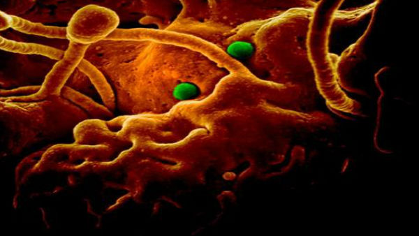 High Alert on All Airport in India Alert on CoronaVirus, Tourist from China are Screened by Thermal Imaging High Alert on All Airport in India Alert on CoronaVirus, Tourist from China are Screened by Thermal Imaging