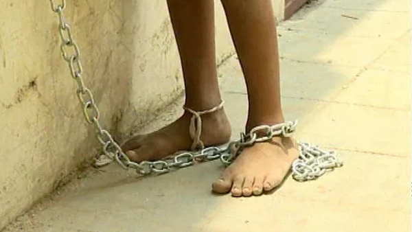 jharkhand ranchi man swallow lock and his operation in rims jharkhand ranchi man swallow lock and his operation in rims
