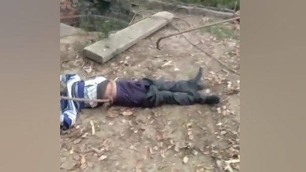 अस्पताल में चल रहा इलाज