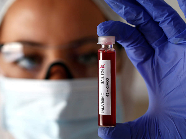 COVID-19: 3 new cases in Gujarat; total rises to 38 COVID-19: 3 new cases in Gujarat; total rises to 38