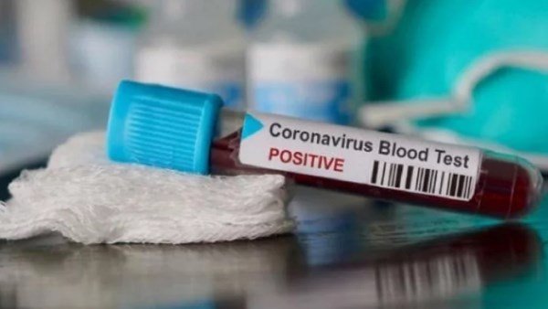 9 patients of Coronavirus recover in Gurugram 9 patients of Coronavirus recover in Gurugram