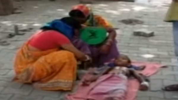 jharkhand jamshedpur horrible burnt bou did not get bed in hospital jharkhand jamshedpur horrible burnt bou did not get bed in hospital