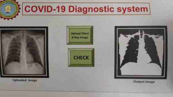 Coronavirus patients will be identified with chest X-rays Coronavirus patients will be identified with chest X-rays