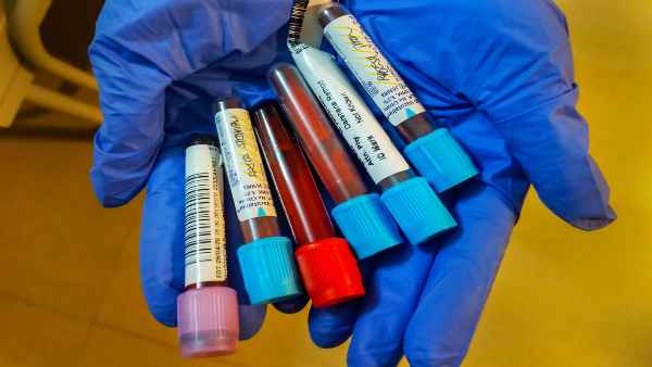 ICMR-NCDC-Sero survey will now be started in selected districts to monitor coronavirus ICMR-NCDC-Sero survey will now be started in selected districts to monitor coronavirus