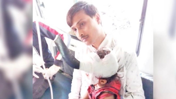 Stand fan petal inserted in the head of a 3-year-old child in khandwa Stand fan petal inserted in the head of a 3-year-old child in khandwa