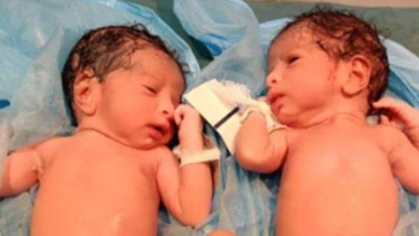 coronavirus, covid-19, covid19, coronavirus positive, woman gave birth to twins, coronavirus positive woman delivers twins, hyderabad hospital, hyderabad, telangana, कोरोना वायरस, कोविड-19, कोविड19, कोरोना वायरस संक्रमित, महिला ने दिया बेटियों को जन्म, कोरोना संक्रमित महिला बनी मां, हैदराबाद अस्पताल, हैदराबाद, तेलंगाना coronavirus, covid-19, covid19, coronavirus positive, woman gave birth to twins, coronavirus positive woman delivers twins, hyderabad hospital, hyderabad, telangana, कोरोना वायरस, कोविड-19, कोविड19, कोरोना वायरस संक्रमित, महिला ने दिया बेटियों को जन्म, कोरोना संक्रमित महिला बनी मां, हैदराबाद अस्पताल, हैदराबाद, तेलंगाना