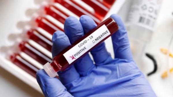 uttar pradesh firozabad coronavirus 18 new positive case uttar pradesh firozabad coronavirus 18 new positive case