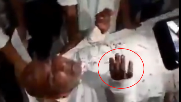 मौत के मुंह में भी नहीं छुटी बीड़ी