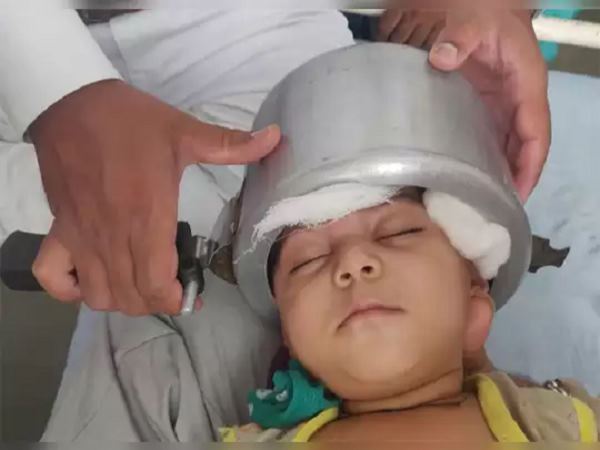 देखकर डॉक्टर्स भी दंग रह गए