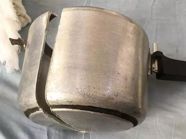 फिर उसे बचाने के लिए कुकर काटी
