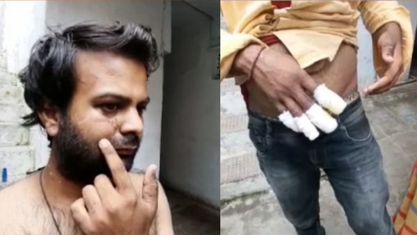 a young man brutally beaten up by tantrik at ujjain a young man brutally beaten up by tantrik at ujjain