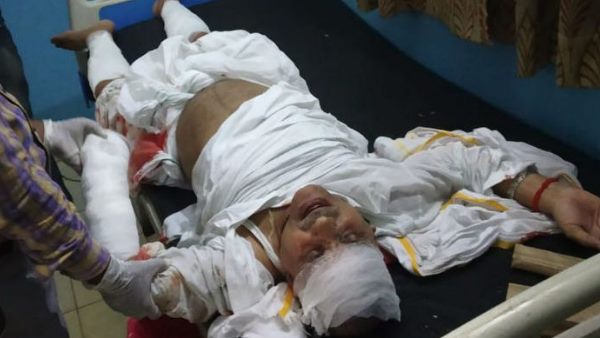 bjp mlc devendra pratap singh injured in road accident in ayodhya bjp mlc devendra pratap singh injured in road accident in ayodhya