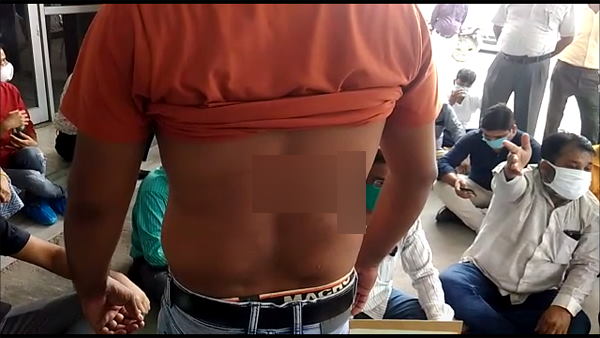 Gorakhpur: In BRD Medical College, Junior doctors beaten a lab technician, checkup closed in hospital Gorakhpur: In BRD Medical College, Junior doctors beaten a lab technician, checkup closed in hospital