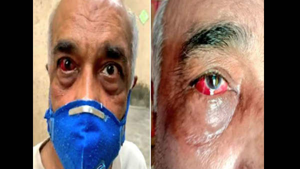 क्या कहना है पुलिस का