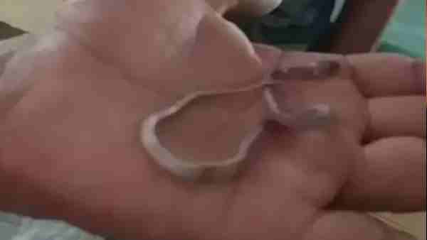 7 इंच का था सांप, इस वजह से हुई मौत