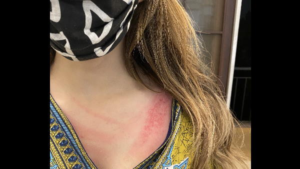 Delhi Kashmiri woman alleges landlady abused her called her terrorist Delhi Kashmiri woman alleges landlady abused her called her terrorist