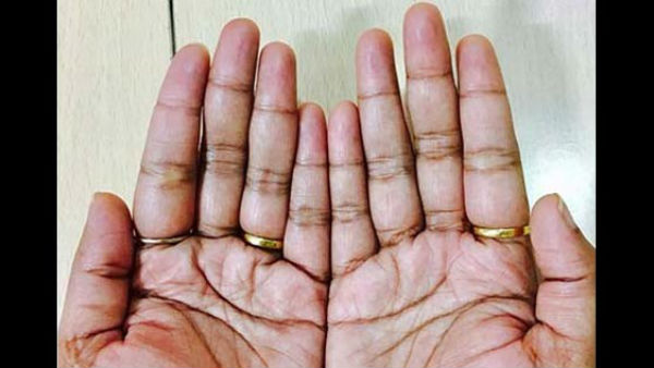 Palmistry: शत्रुओं से रक्षा करता है हथेली में गदा का चिन्ह Palmistry: शत्रुओं से रक्षा करता है हथेली में गदा का चिन्ह