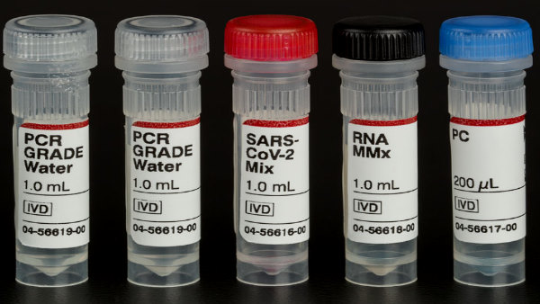 RT-PCR test RT-PCR test