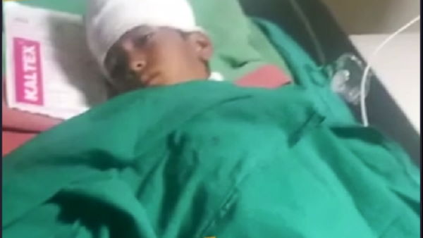 Five Dogs Attacked A 8 year old Child near home, admitted In ahmedabad civil hospital Five Dogs Attacked A 8 year old Child near home, admitted In ahmedabad civil hospital