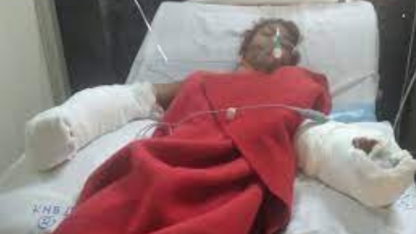 husband cut off wife hands after love marriage in Madhya pradesh husband cut off wife hands after love marriage in Madhya pradesh