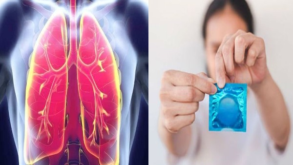 शुरुआत में लगा टीबी का केस