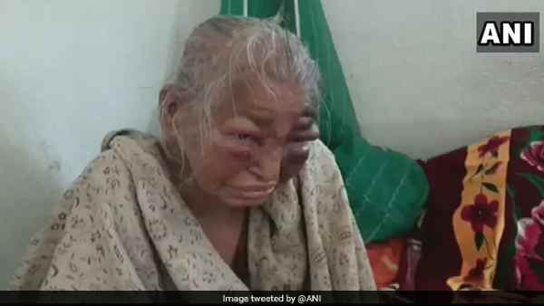 बुजुर्ग महिला ने लगाया है हमले का आरोप