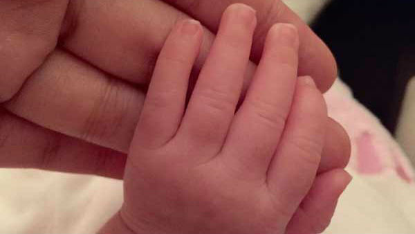 APGAR score से बच्चे की कंडीशन का पता लगाया गया
