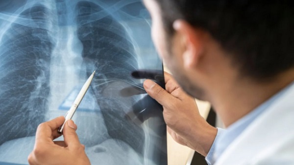 Lungs Test Lungs Test