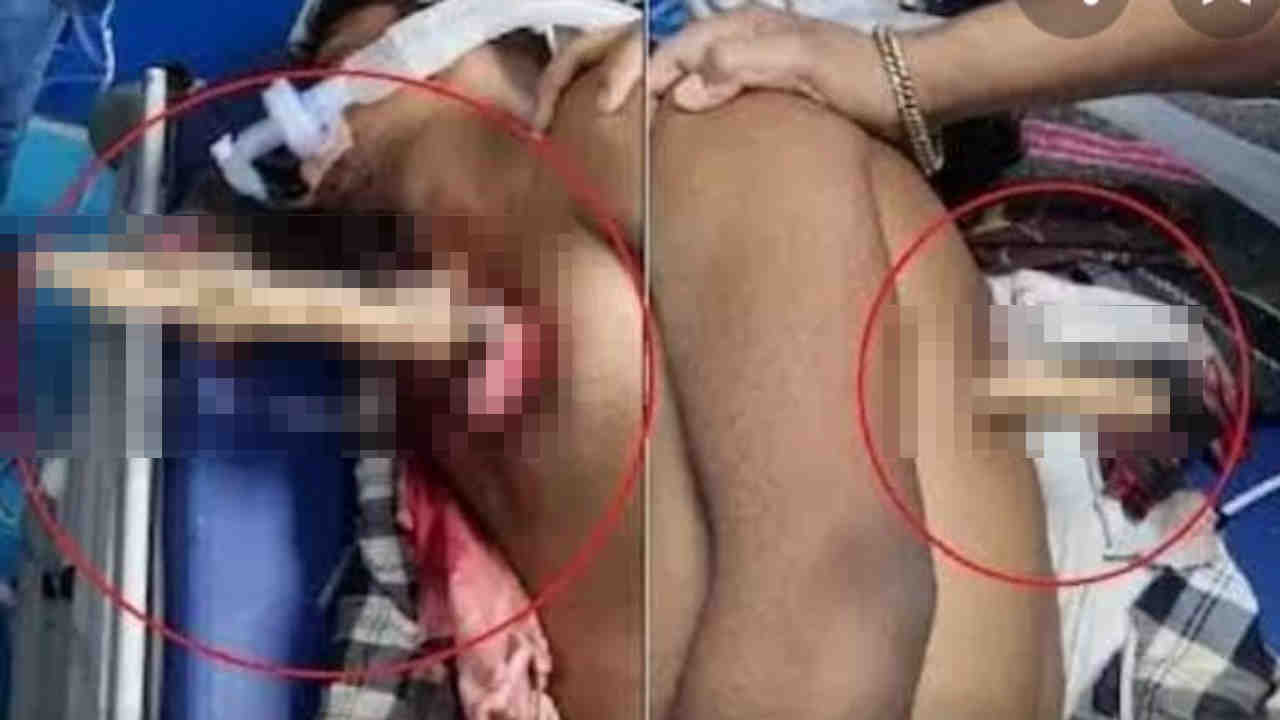 After hitting bullock cart wood crossed bike riders chest in Sagar Madhya Pradesh After hitting bullock cart wood crossed bike riders chest in Sagar Madhya Pradesh
