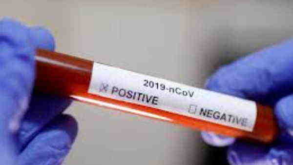 bihar corona update 991 new case of covid 19 bihar corona update 991 new case of covid 19