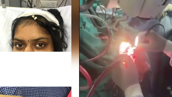 ऑपरेशन टेबल पर हनुमान चालीसा पढ़ती रही लड़की