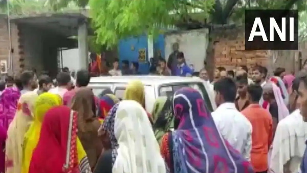 तीन सिर वाले बच्चे ने लिया जन्म