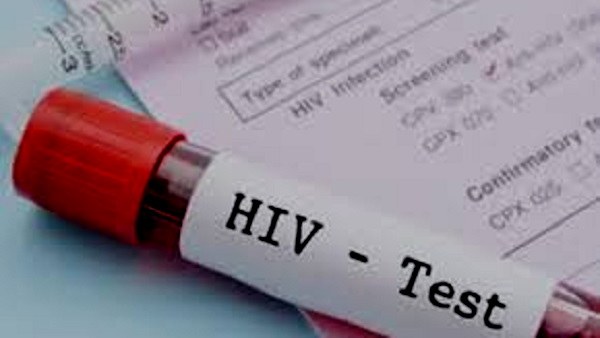 AIDS AIDS
