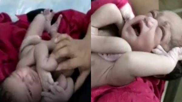 बच्चे को देखकर परिजन हुए हैरान