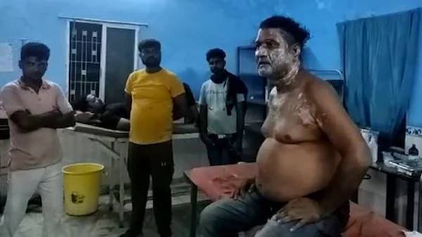तेज़ाब के हमले से झुलसा शरीर