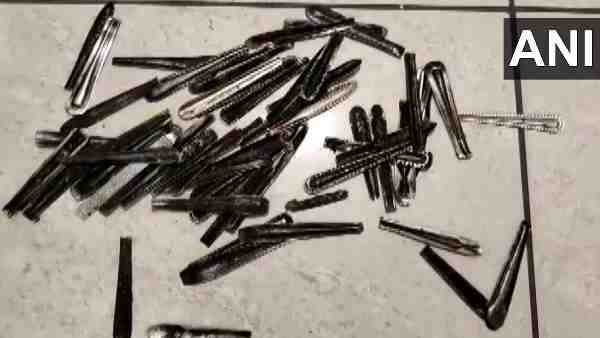 63 spoons have been taken out from the stomach of 32-year-old patient, Vijay in Muzaffarnagar 63 spoons have been taken out from the stomach of 32-year-old patient, Vijay in Muzaffarnagar