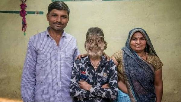 लोग कहते हैं मंकी बॉय