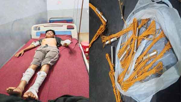 मंदिर में दीया जलाने पहुंचा था तरुण, डेटोनेटर से था अनजान