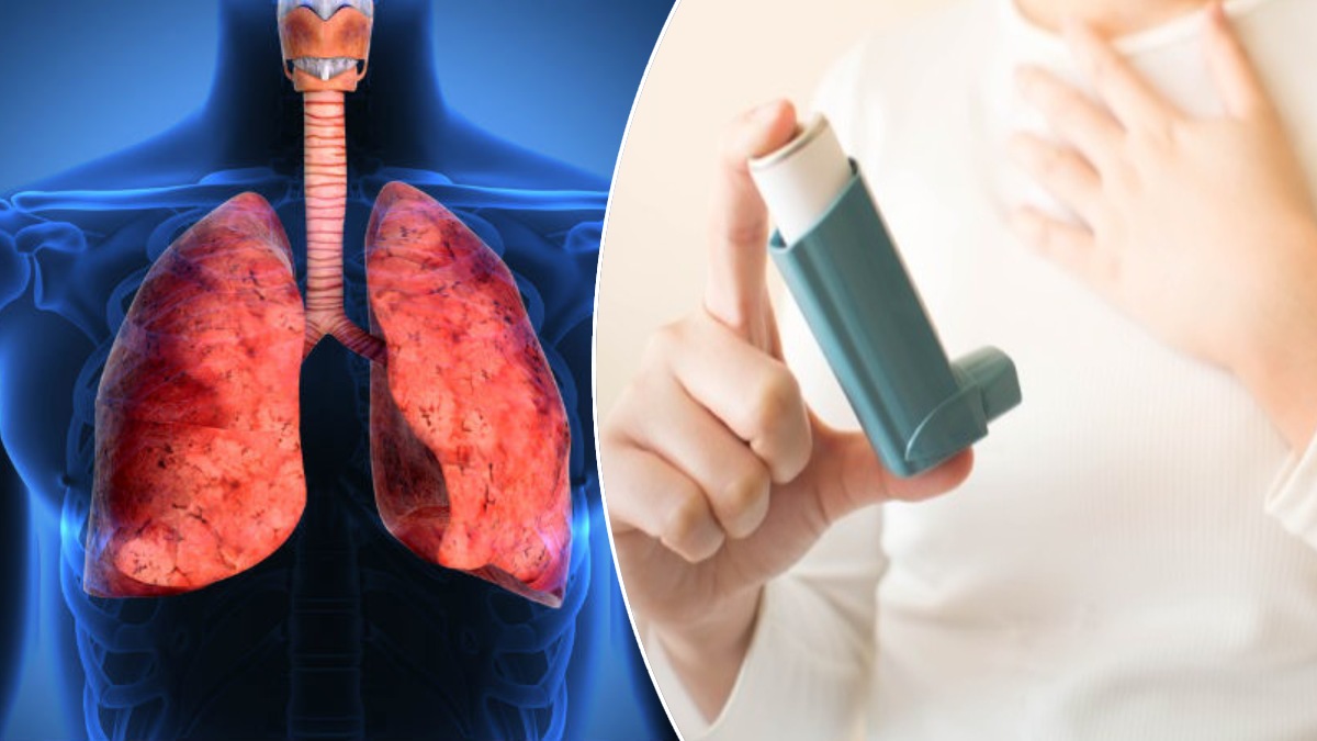 Asthma सर्दियों में अस्थमा, जानें कैसे है बचना! Why Asthma Is Worse