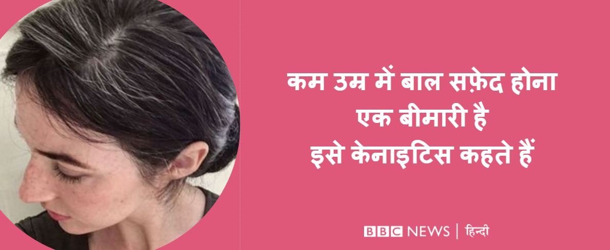 सफेद बाल सफेद बाल