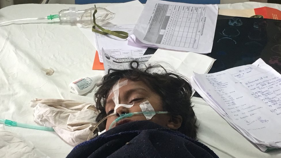 गोरखपुर , इंसेफेलाइटिस गोरखपुर , इंसेफेलाइटिस