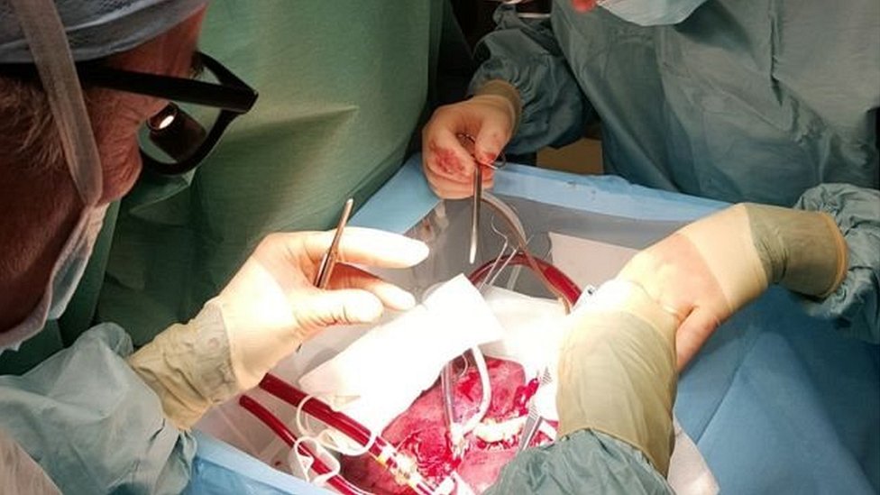 लीवर प्रत्यारोपण, लीवर, प्रत्यारोपण, liver transplantation, liver, transplantation लीवर प्रत्यारोपण, लीवर, प्रत्यारोपण, liver transplantation, liver, transplantation