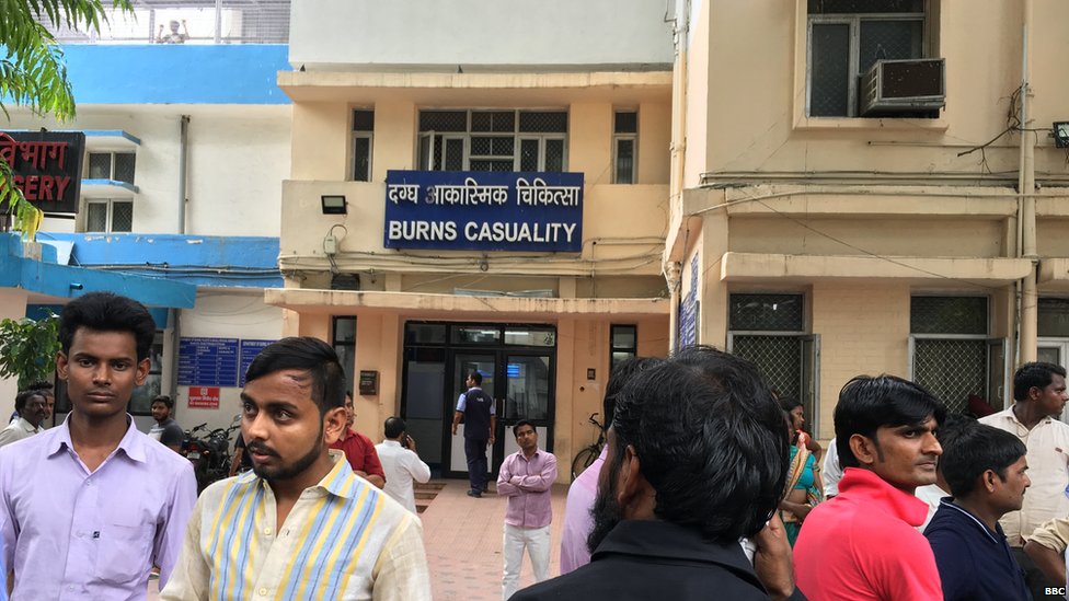 सफ़दरजंग का बर्न वॉर्ड सफ़दरजंग का बर्न वॉर्ड