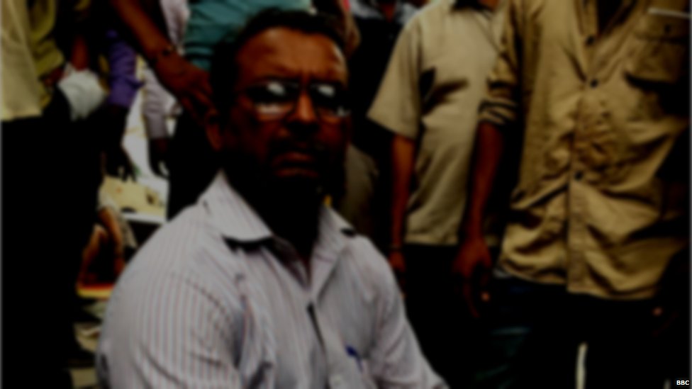 सफ़दरजंग का बर्न वॉर्ड सफ़दरजंग का बर्न वॉर्ड