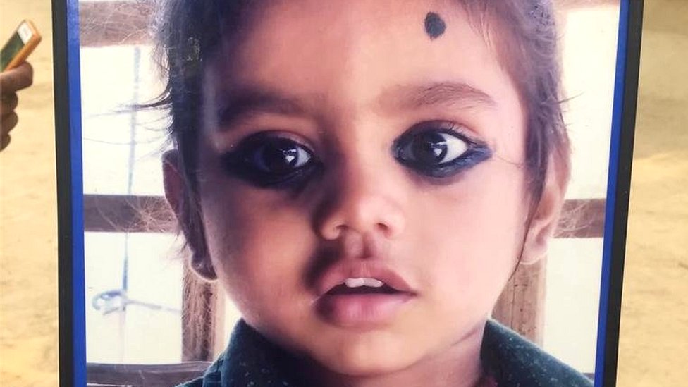 इंसेफिलाइटिस इंसेफिलाइटिस
